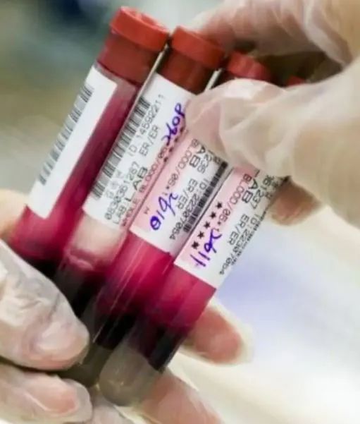 印度500只蝙蝠集體暴斃，專家找出“致命原因”人類(lèi)也恐遭殃