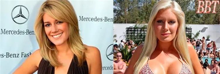 14個光速衰老的好萊塢明星今昔大對比，整形卻整的更壞