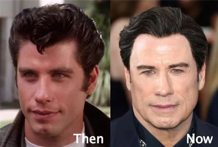 14個光速衰老的好萊塢明星今昔大對比，整形卻整的更壞