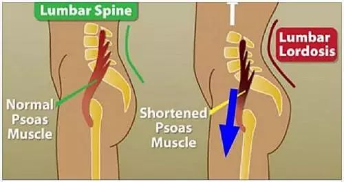 瑜珈大師解釋人T里靈魂的肌肉是造成生理疼痛的主因！