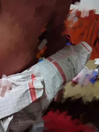 他手術前2天“6年白龍魚”翻肚暴斃，風水魚擋煞拿命報恩