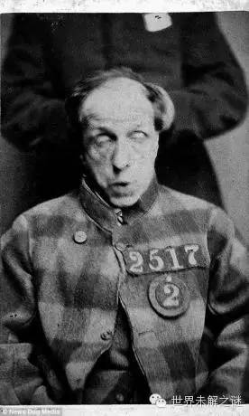 英國第一批精神病人…看完有些臉容易做惡夢