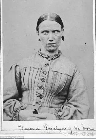 英國第一批精神病人…看完有些臉容易做惡夢