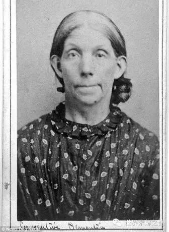 英國第一批精神病人…看完有些臉容易做惡夢