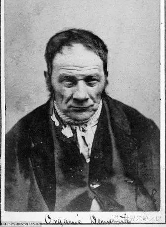 英國第一批精神病人…看完有些臉容易做惡夢