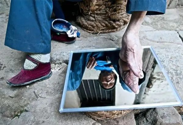 古代傳統極端纏足文化照片，X光看起來太可怕！