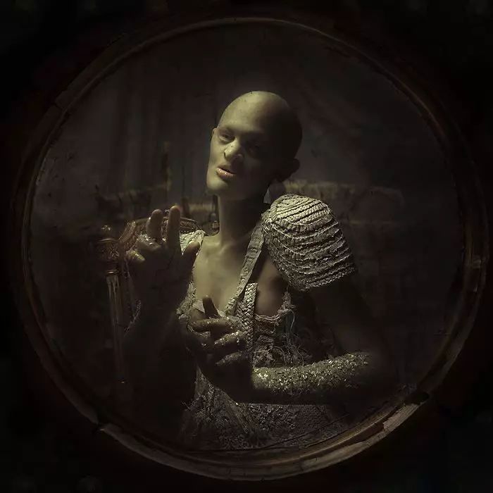 28歲患有罕見基因異常疾病的女模打破了眾人對時尚的印象