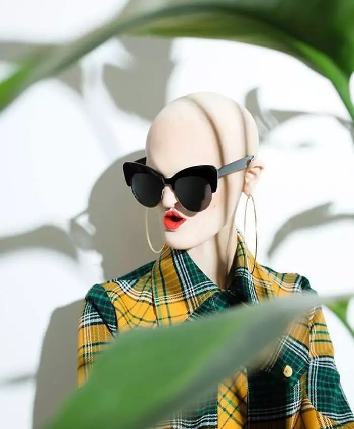 28歲患有罕見基因異常疾病的女模打破了眾人對時尚的印象