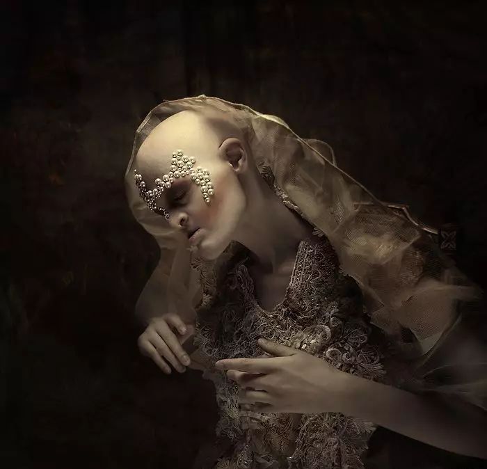 28歲患有罕見基因異常疾病的女模打破了眾人對時尚的印象