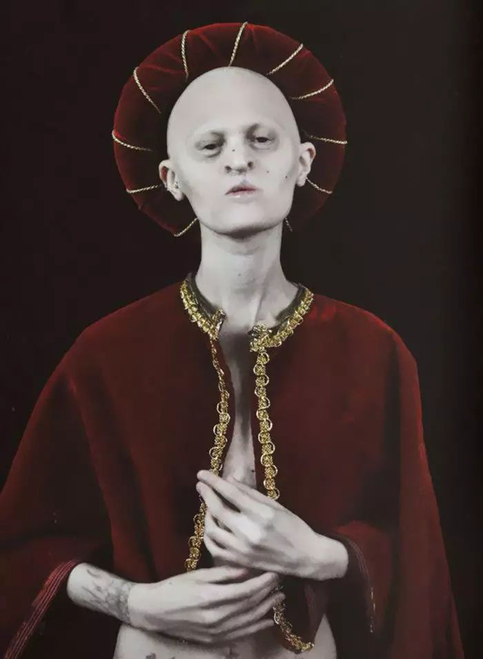 28歲患有罕見基因異常疾病的女模打破了眾人對時尚的印象