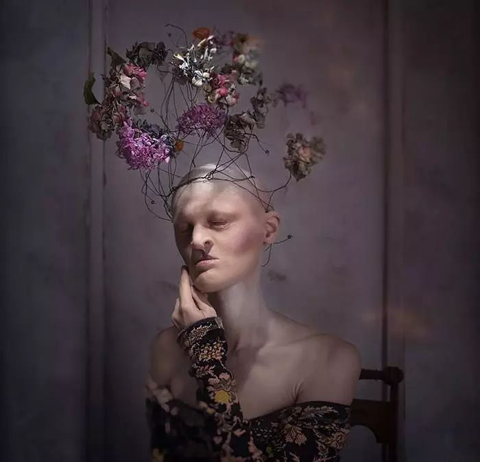 28歲患有罕見基因異常疾病的女模打破了眾人對時尚的印象