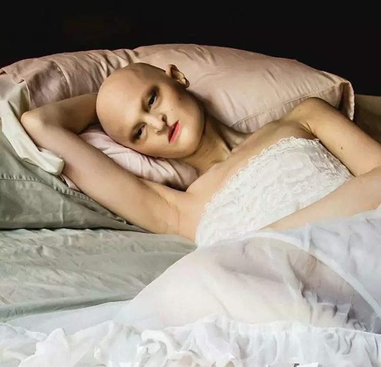 28歲患有罕見基因異常疾病的女模打破了眾人對時尚的印象
