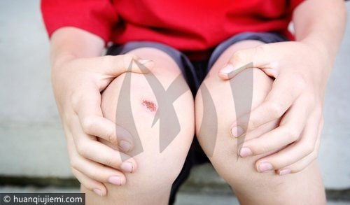 國外發明醫療用膠水，60秒就能把傷口、器官黏起來！